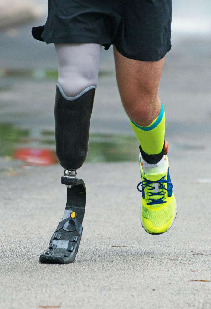 man running with prosthetic legs